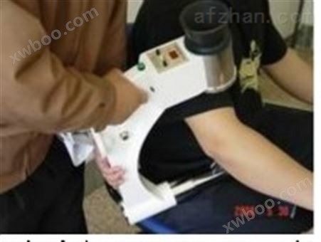 手提式X光机/矫形骨科用便携式X光机